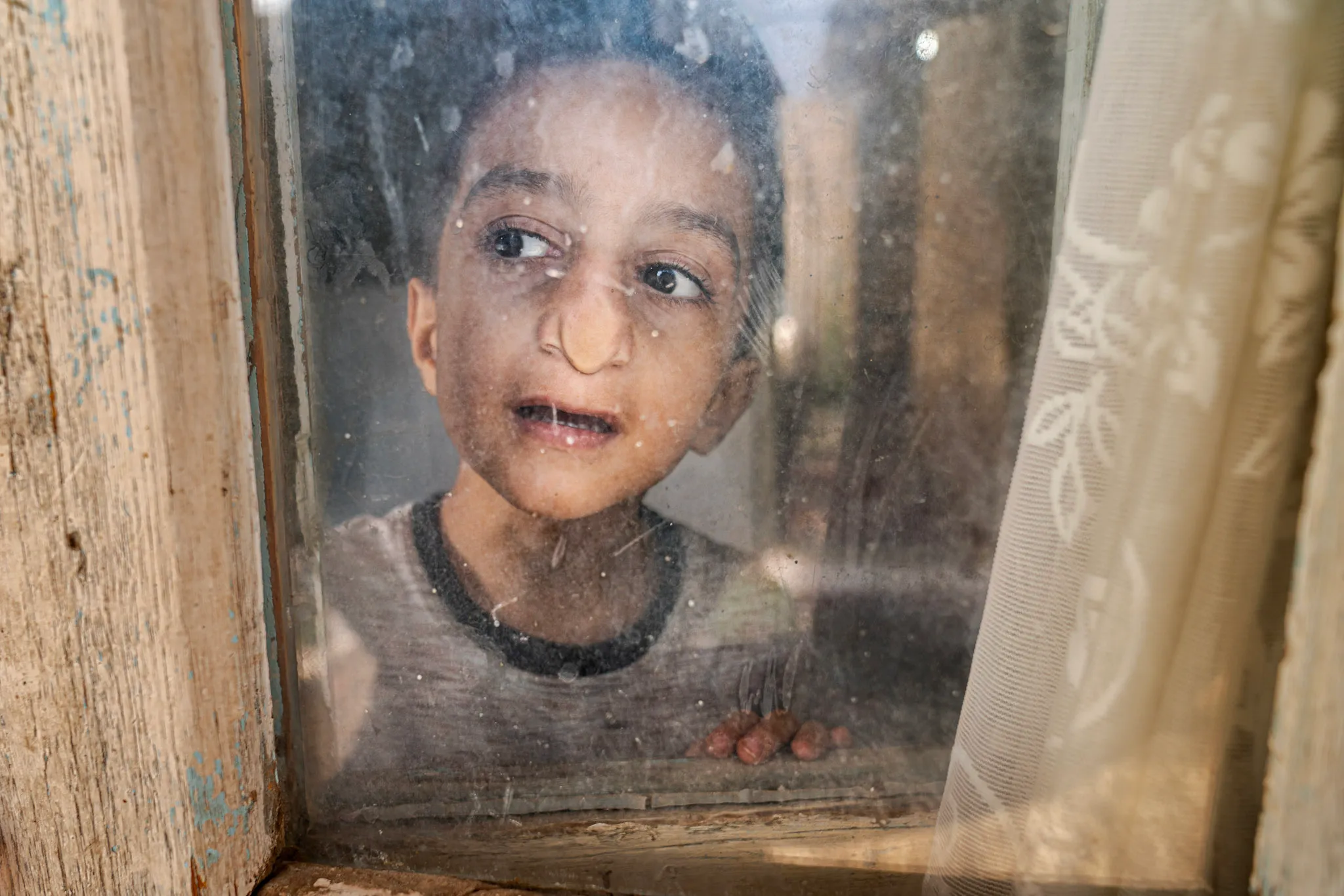 Face at the Window